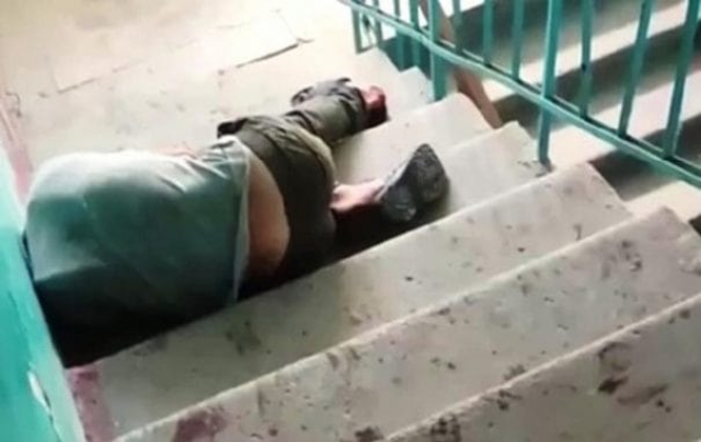 В Харькове бультерьер напал на гостей хозяйки – пострадал 33-летний мужчина