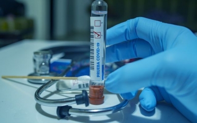 Коронавирус обнаружен у годовалой девочки из г. Валки