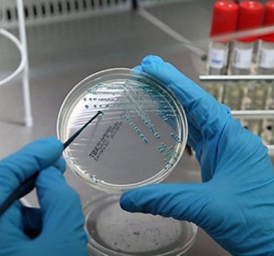 В масле и молоке выявили кишечную палочку