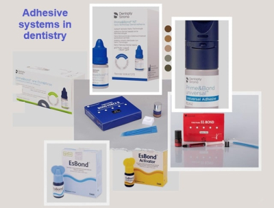 Адгезивні системи в стоматології: що це таке, види, застосування