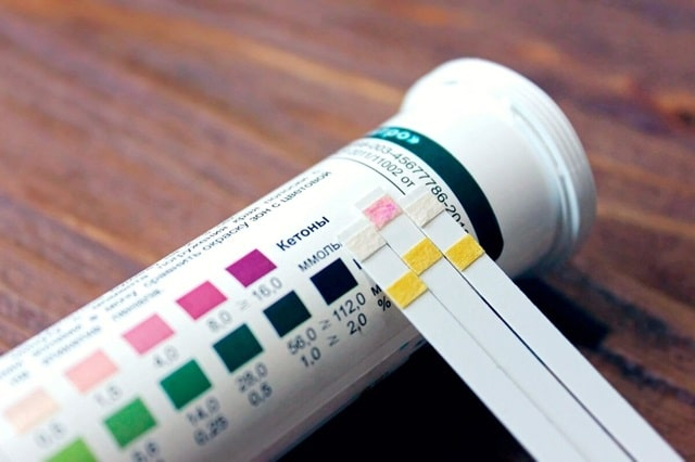 Як спосіб життя впливає на рівень ацетону в організмі?