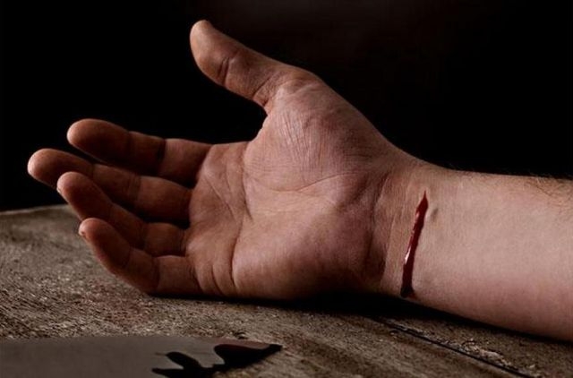 Молодой мужчина покончил с жизнью в лесу