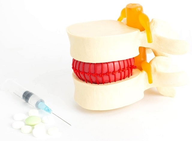 Хондропротектор: как выбрать препарат для суставов?
