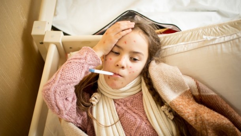 Корь не отступает: на Харьковщине увеличилось количество заболевших