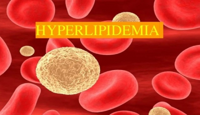 Гиперлипидемия: что это такое, причины, симптомы, профилактика