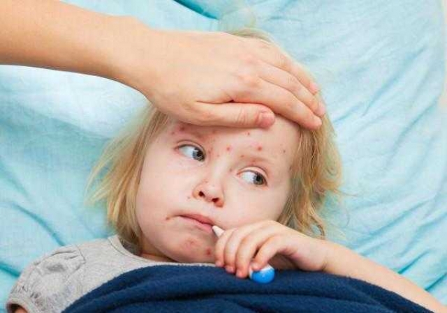 Корь на Харьковщине не отступает, болеют даже привитые