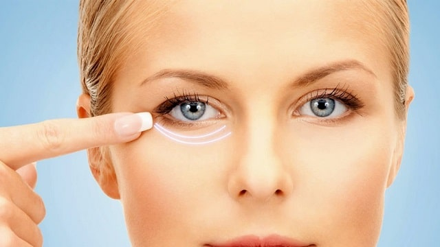 Нижняя блефаропластика: что это такое, особенности процедуры, как проходит