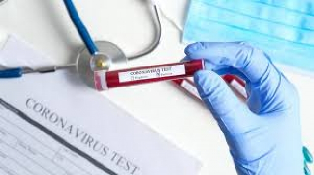 У 100 больных пневмонией не нашли коронавируса