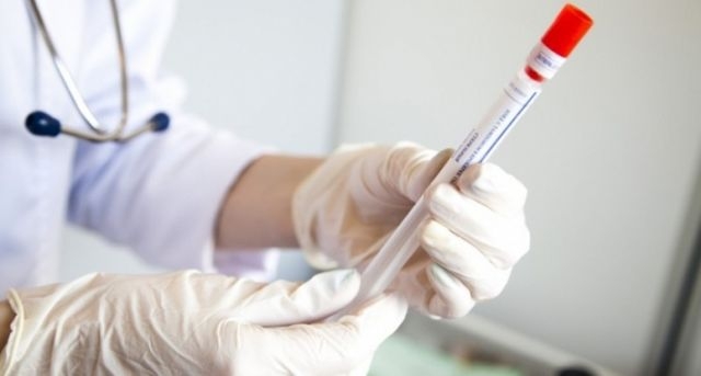 Специалисты продолжают фиксировать случаи заболеваний гепатитом А в области