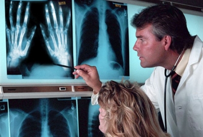 Харьковчанам рассказали об артрите