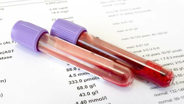 Биохимический анализ крови: почему он необходим