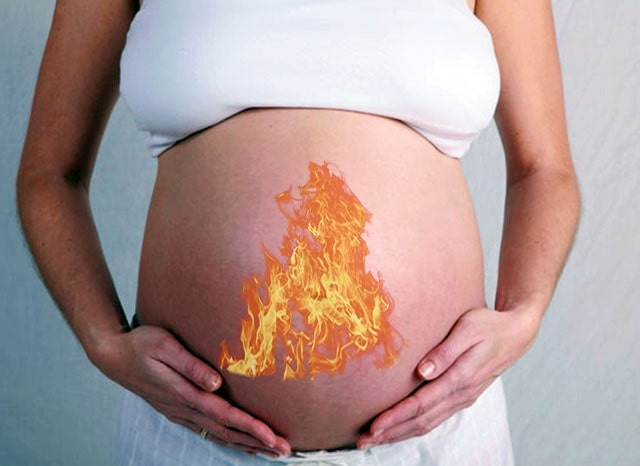 Изжога при беременности: как проявляется, причины возникновения