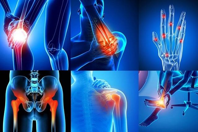 Профилактика заболеваний суставов: что нужно делать, и что нельзя