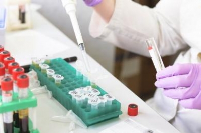 10 сотрудников областного лабораторного центра заболели коронавирусом