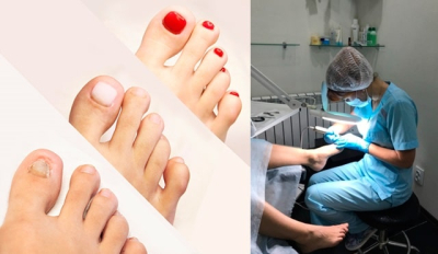 Гель для протезирования ногтей: что это, как используется, преимущества применения