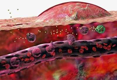 Противовоспалительные препараты: что это такое, виды, применение