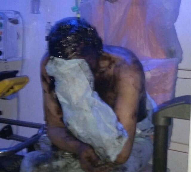 В пос. Боровая мужчина два часа просидел в битумно-смоляной яме