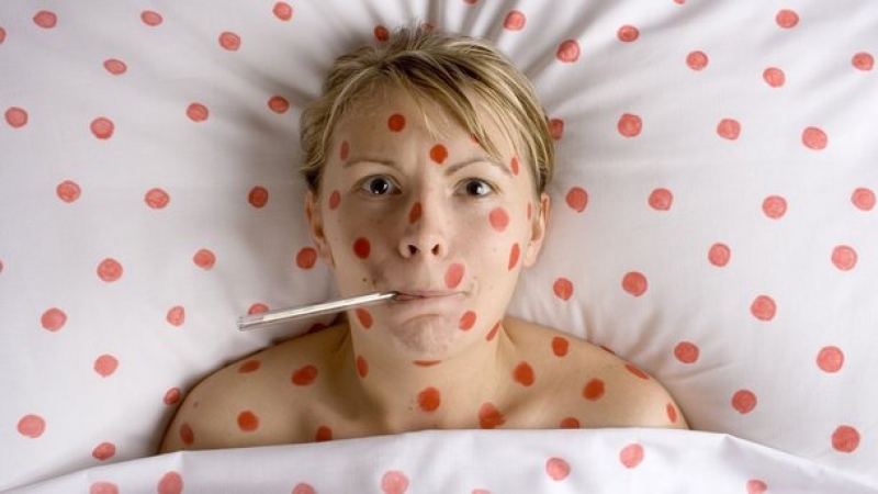 В Харькове и регионе продолжает расти количество заболевших корью