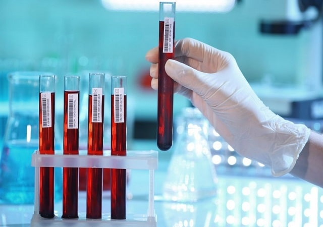 Анализ крови: виды, что показывают, как подготовиться