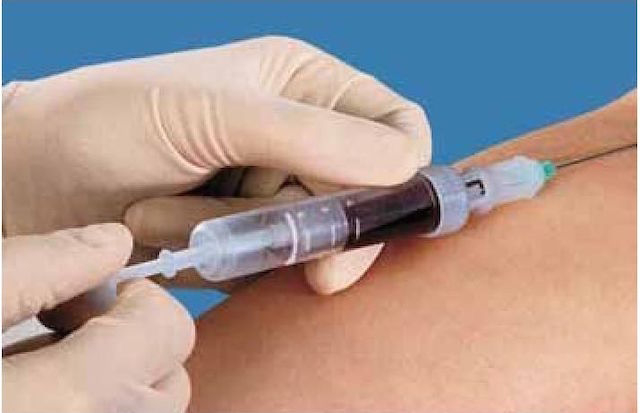 В амбулатории Валковской громады появилось оборудование для анализа крови