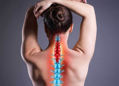 Юнацький кіфоз Шейермана: що це таке, чому виникає, чим небезпечний