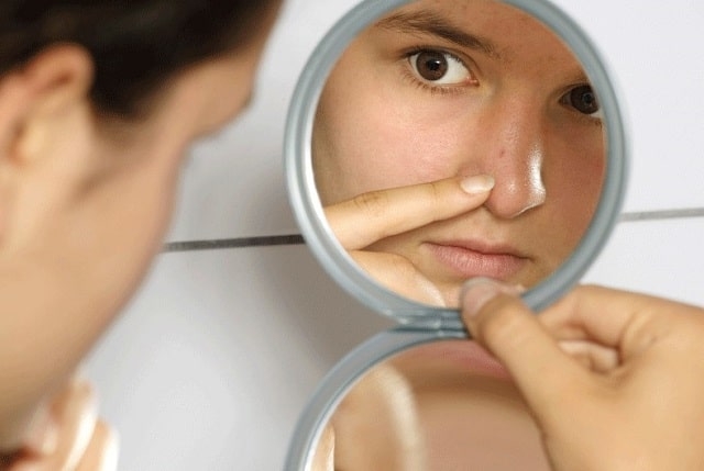 Как ухаживать за жирной кожей лица в подростковом возрасте