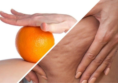 Антицеллюлитный массаж: что это такое и как работает, чем он полезен
