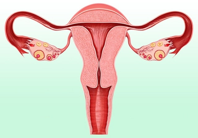 Эндометриоз матки: что это такое, понятное объяснение