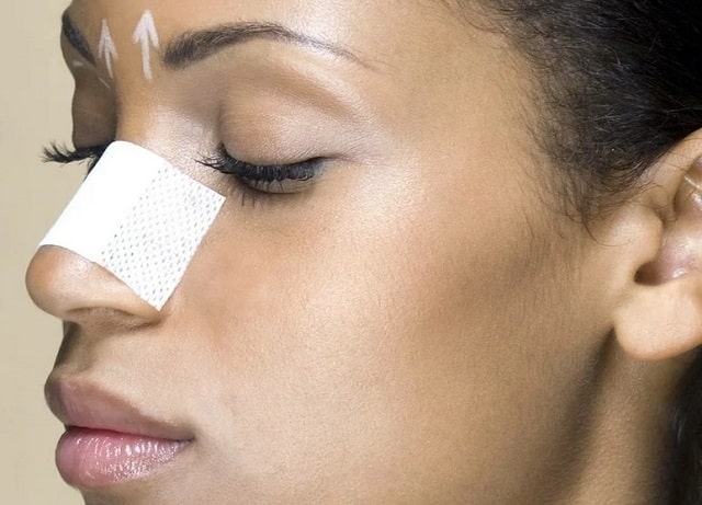 Ринопластика: что это такое и как проходит