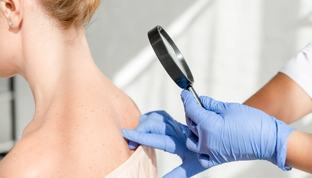 Коли варто звернутися до дерматолога у Києві