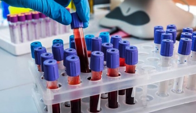 На Харьковщине динамика распространения коронавируса выше нормы