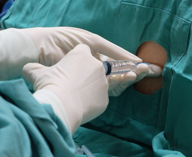 Пункция: что это такое, когда и зачем назначается