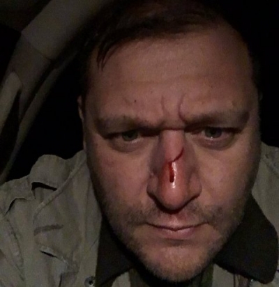 Добкин получил в нос во время охоты на чумных свиней