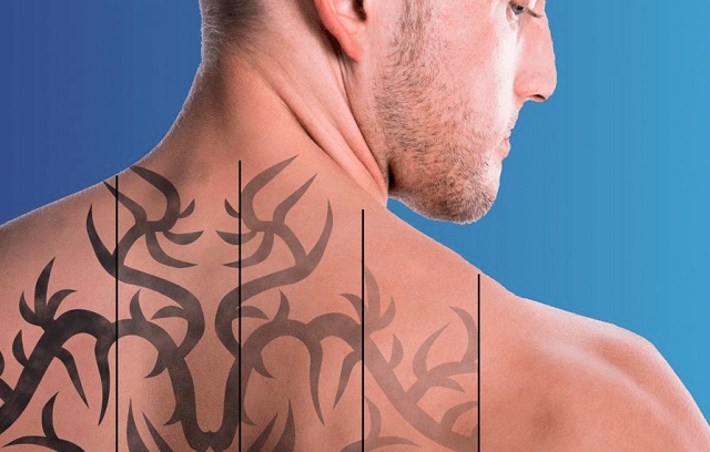 Что делать, если мне не нравится моя татуировка?
