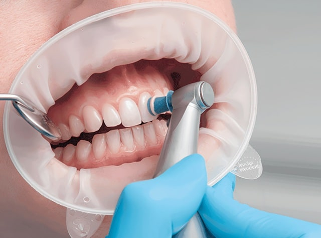 Профессиональная чистка раз в полгода: зачем, если я хорошо чищу дома?