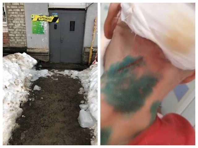 Гигантская сосулька упала на харьковчанина (фото)