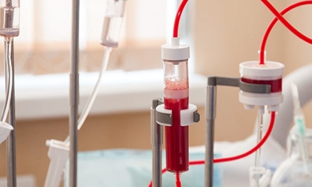 В двух больницах Харькова можно бесплатно очистить кровь – приказ Минздрава